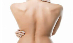 Picture of a woman’s back showing a recent liposuction procedure.