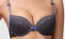 Picture of a woman’s breasts showing the results of her breast lift along with a breast reduction