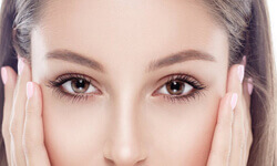 Portrait picture of a woman looking straight at the camera, showing her eyelid lift procedure.