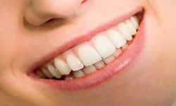 Picture of a smiling patient showing her satisfaction with a holistic periodontal treatment.