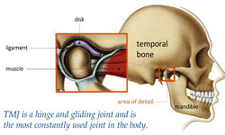 Illustration of a temporo mandibular condition with a suggested holistic treatment