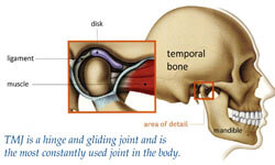 Illustration of a temporo mandibular condition with a suggested holistic treatment
