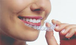 Picture of a dental patient holding invisible braces aligners up to her teeth.