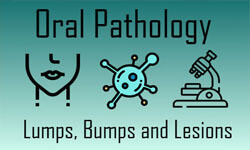 Illustration of oral pathology description with the words lumps, bumps and lesions.