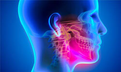 Illustration of a patient’s head showing the areas of problems when having orofacial pain.