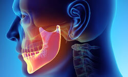 Illustration of the skull and jaw showing the problem areas of TMJ disorder.