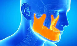 Illustration of the skull and jaw showing the problem areas of TMJ disorder.