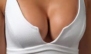 Picture of a woman's breasts showing the result of breast implants