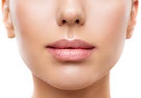 Close-up picture of woman’s face showing the lip augmentation procedure she had in Costa Rica.