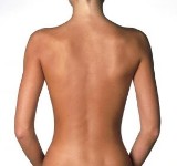 Picture of a woman’s back showing a recent liposuction procedure.
