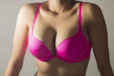 Close-up photo of a woman in a bright pink bra showing a breast implants removal procedure she had in Costa Rica.