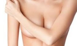 breast-lift-with-reduction-procedure