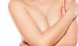 Close-up picture of a woman with an arm over her breasts, showing the results of a breast reconstruction procedure she had in Costa Rica.