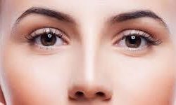 Portrait picture of a woman looking straight at the camera, showing her eyelid lift procedure she had in Costa Rica.