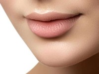 Picture of a woman’s plump lips showing a perfect lip fillers procedure she had in Costa Rica