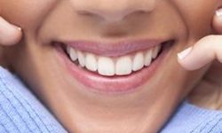 Picture of a smiling woman displaying her dental crowns procedure she had in Costa Rica.