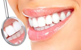 Picture of a smiling woman displaying the dental makeover procedure she had in Costa Rica.