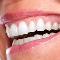 Picture of a smiling woman displaying the dentures procedure she had in Costa Rica.