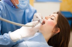 Picture of a sleeping woman in a dental chair showing how holistic sleep dentistry is practiced in Costa Rica.