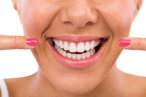 Picture of a smiling woman displaying the metal-porcelain crowns she had in Costa Rica.