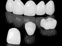 Picture a row of 5 pure porcelain zirconium emax crowns, and 3 individual crowns.